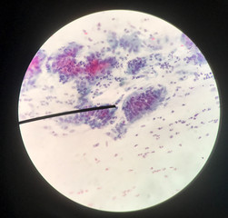 Cells in reproductive female cytology and histology concept.