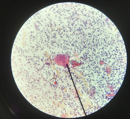 Cells in reproductive female cytology and histology concept.