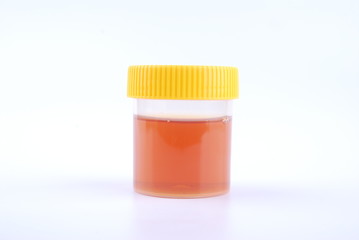 bottles of urine test sample