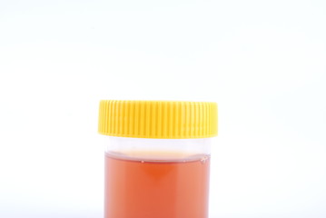 bottles of urine test sample