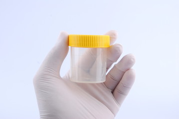 Hand hold bottles of urine test sample