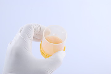 Hand hold bottles of urine test sample