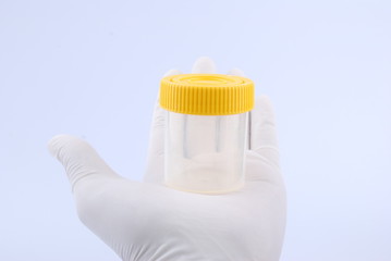 Hand hold bottles of urine test sample