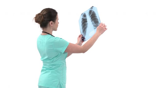 Professional female doctor examining x-ray of lungs. Specialist holds transparent image of chest in arms and researches it. Medical diagnostic concept