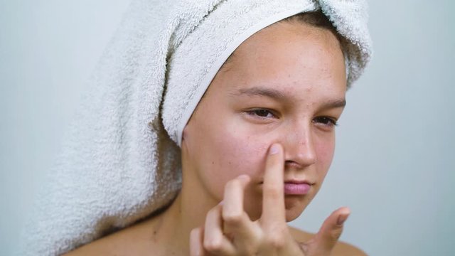 Sad teenager with bath towel on head frowning at her acne face skin