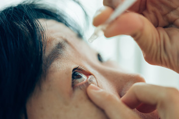 Woman use eye drop, artificial tears to the eye