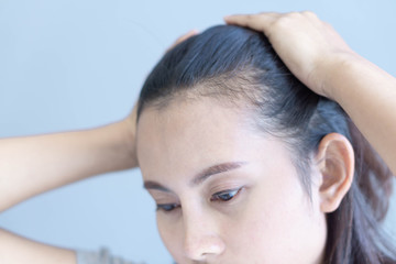 Naklejka premium Woman serious hair loss problem for health care shampoo and beauty product concept, selective focus