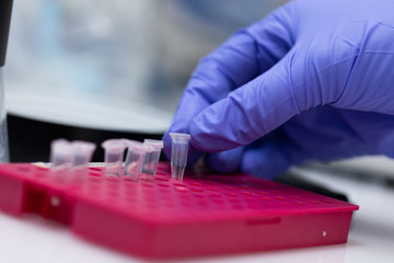 Polymerase Chain Reaction (PCR) and Agarose gel electrophoresis is a method of gel electrophoresis used in biochemistry, molecular biology, genetics, and clinical chemistry in lab.