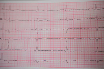 Getting ready. Doctor in white robe getting the patient ready for electrocardiogram