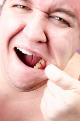 Naklejka premium Caries. Funny fat guy is brushing his teeth.