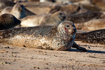 Injured female common seal (harbour seal) lying on a beach with fresh bleeding wounds