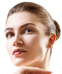 Circle on young woman shows before and after treatment and makeup.
