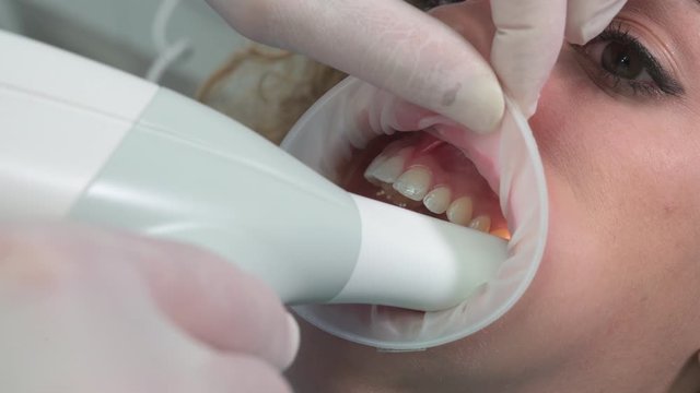Dentist using innovative 3d ultrasound for dental check