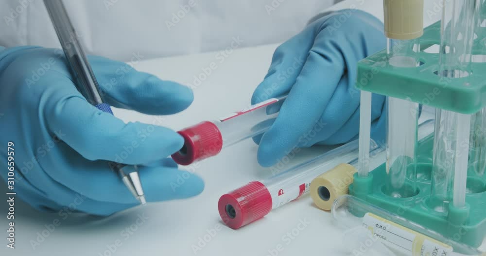 Wall mural Close up shot of laboratory assistant signs pen test tubes to collect analysis and further research