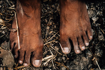 poor child or beggar begging you for help sitting at dirty slum. concept for poverty or hunger...