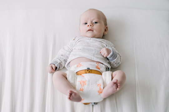 Baby with Hip Dysplasia