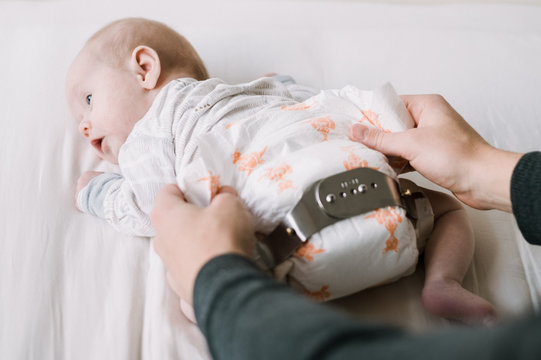 Baby with Hip Dysplasia