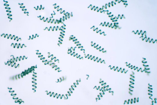 Cyanobacteria Bilder Durchsuchen 7,397 Archivfotos,