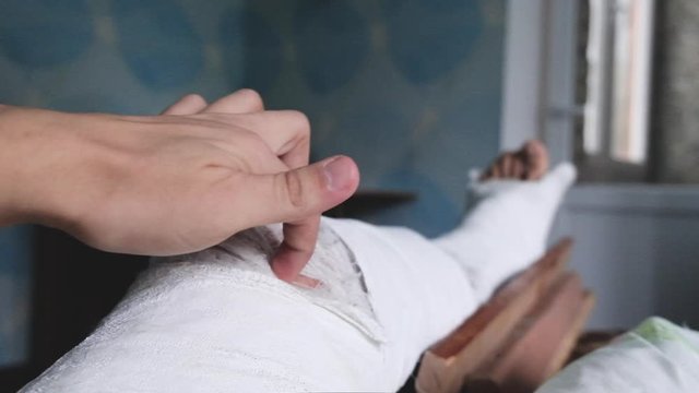 Young man with broken plaster leg trying to scratch injured itching places