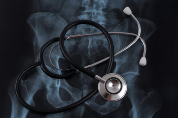 Stéthoscope sur une radiographie de bassin