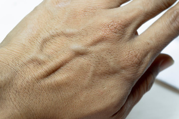 Hand back of men showing blood vessel