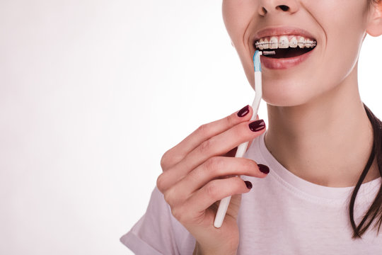 Close up and cut view of interdental brush in young woman's hand. Cleaning teeth and braces. Dental care. Modern technique. Rubber bands for braces. Young woman isolated.