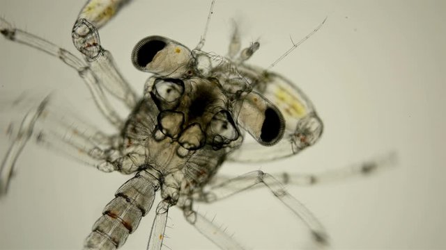 The crab larva under the microscope, at the megalope stage, has already sunk to the bottom and after molting will become a full-fledged small crab