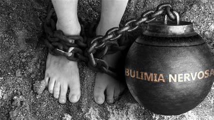 Bulimia nervosa as a negative aspect of life - symbolized by word Bulimia nervosa and and chains to show burden and bad influence of Bulimia nervosa, 3d illustration - obrazy, fototapety, plakaty