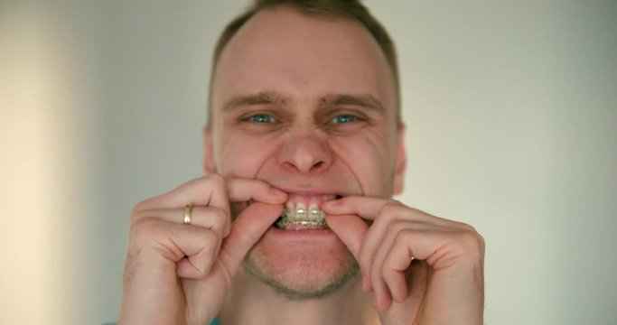 Close up of young white man who is checking his braces with his fingers