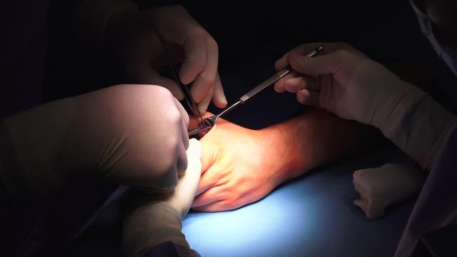 The act of performing surgery may be called a surgical procedure, operation, or simply "surgery". In this context, the verb "operate" means to perform surgery.