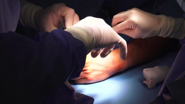 The act of performing surgery may be called a surgical procedure, operation, or simply "surgery". In this context, the verb "operate" means to perform surgery.
