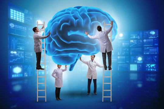 Team of doctors examining human brain