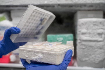 The researcher opens the storage box that keeps the sample in -80C refrigerator. To finds samples of protein used for the further experiment for biochemical laboratory.