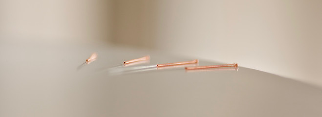 vier kupfer akupunkturnadeln bronze metall gewendelt 