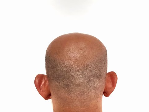 Bald back view. Asian man.