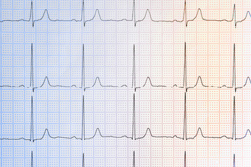 Cardiogram background. Medical pulse line heart. ECG cardiogram pulse graph on a paper