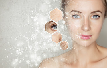 beautiful woman`s face over grey background with snow and snowflakes. Cryolifting beauty procedure...