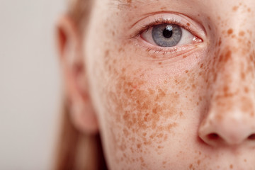 Inclusive Beauty. Girl with freckles standing isolated on grey looking camera concentrated eye close-up close-up - obrazy, fototapety, plakaty
