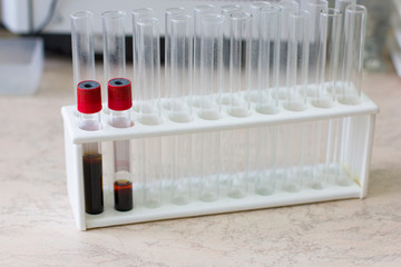 Test tubes with blood. Medical laboratory.