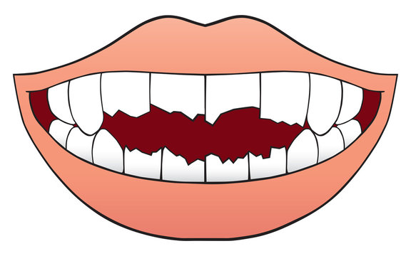 Mouth Full of Broken Teeth