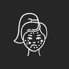 Acne chalk icon. Pimples on female face. Skincare for inflammation and irritation. Facial treatment. Puberty and teenager health problem. Dermatology. Isolated vector chalkboard illustration
