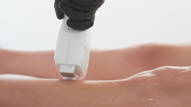 closeup of laser foot hair removal