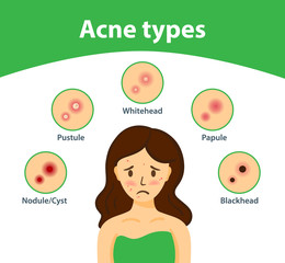 Acne types and sad girl with acne on face. Vector woman face. Skin care illustration.