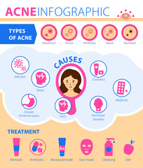 Types of acne, causes of the disease, treatment. Infographics of acne.