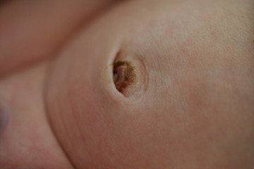 Fototapeta premium navel of newborn baby, closeup image