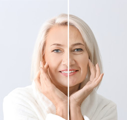 Comparison portrait of mature woman after and before filler injection on light background