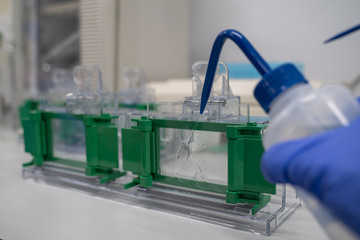 The general process preparation for protein levels detection is using western blot analysis. This method is involved in Protein separation by gel electrophoresis.
