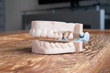 Teeth printed by 3d printer. Upper and lower jaw of adult. Used to create aligners, night guards, braces, crowns, dentures and surgical guides.  The 3D printed teeth model is on a wood table.
