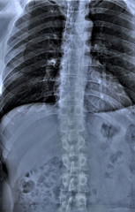 chest and abdominal x-rays, medical diagnosis