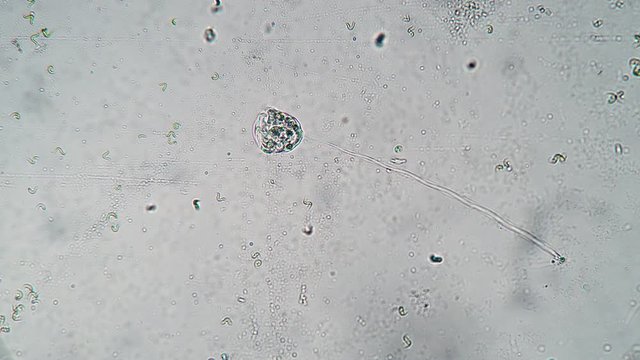 Long infusoria vorticella feeds on bacteria in troubled waters timelapse. Theme of laboratory biological research under microscope. Microscopic protozoa in a drop of water under magnification.